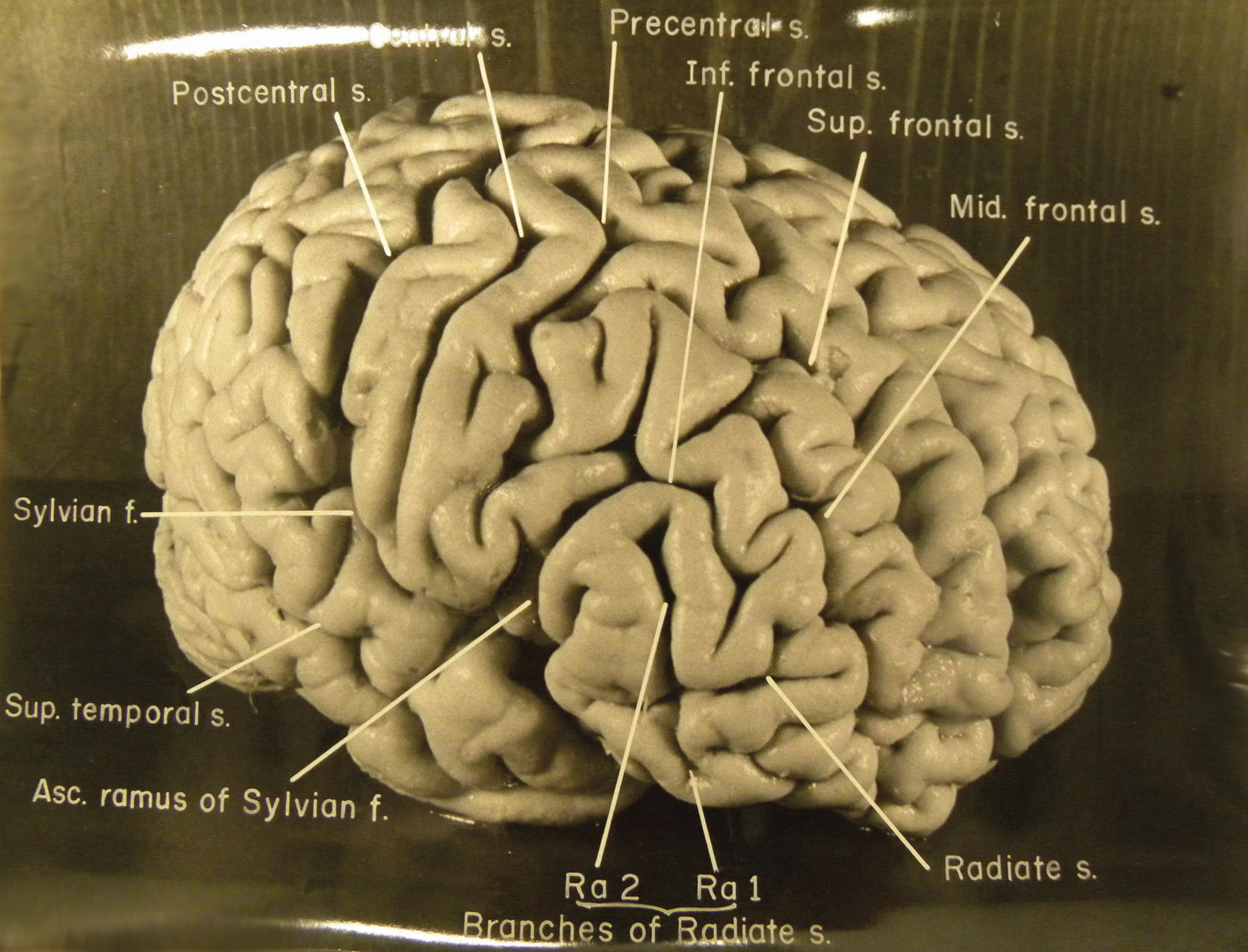 As an avowed atheist, and to avoid idolization, Einstein stipulated in his will that his body be cremated and his ashes scattered into a New Jersey river. But pathologist Thomas Harvey preserved the great scientist’s brain and eyes, later providing slices of brain tissue for neurological research. Einstein’s brain