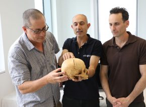 Professor Boaz Zisu, Dr. Nagar and Dr. Cohen with the fractured skull