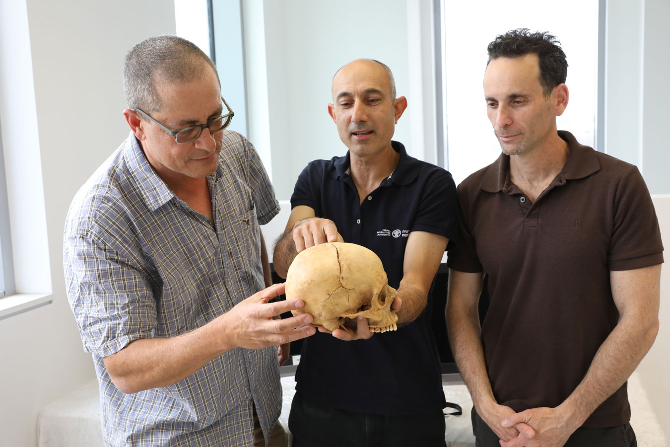 Professor Boaz Zisu, Dr. Nagar and Dr. Cohen with the fractured skull