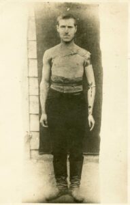 Though Trumpeldor’s disability was legendary, he neither flaunted it nor let it hold him back. A rare photograph exposing his prosthesis